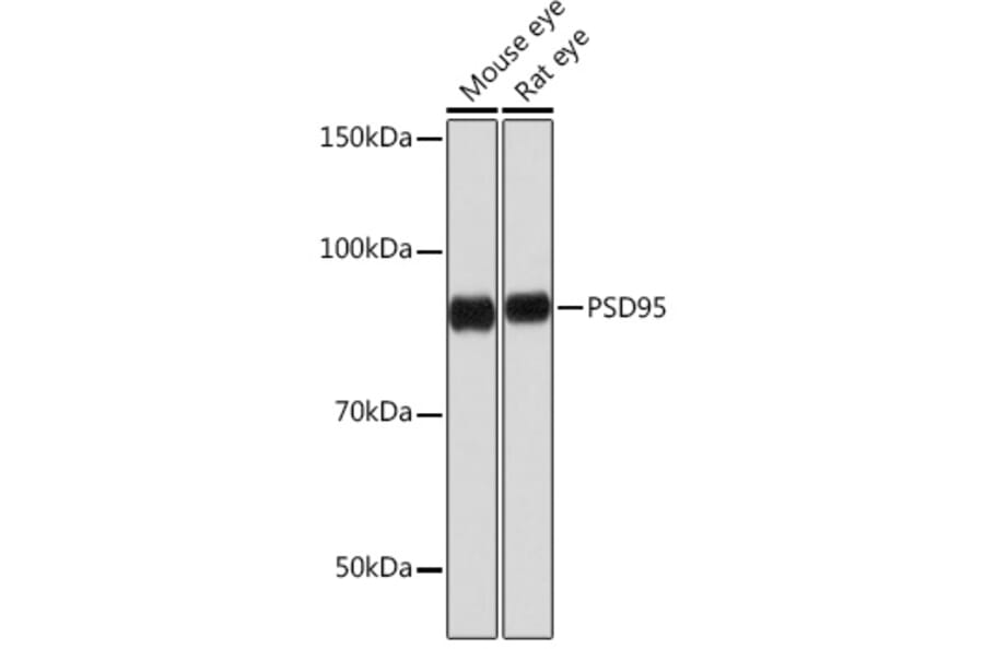 Western Blot - Anti-PSD95 Antibody [ARC0236] (A307116) - Antibodies.com