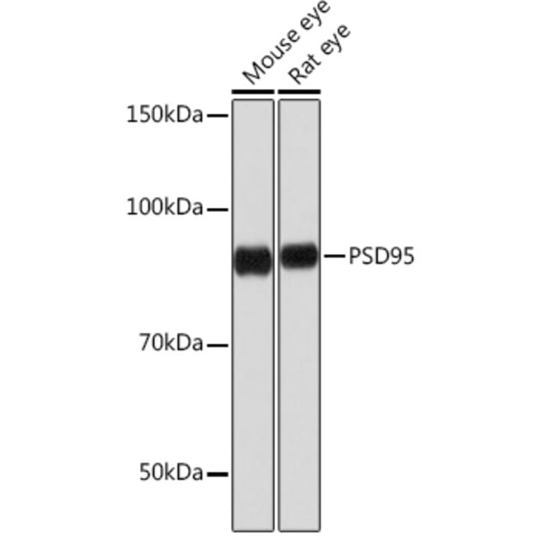 Western Blot - Anti-PSD95 Antibody [ARC0236] (A307116) - Antibodies.com