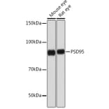 Western Blot - Anti-PSD95 Antibody [ARC0236] (A307116) - Antibodies.com