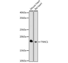 Western Blot - Anti-TNNC1 Antibody [ARC0840] (A307117) - Antibodies.com