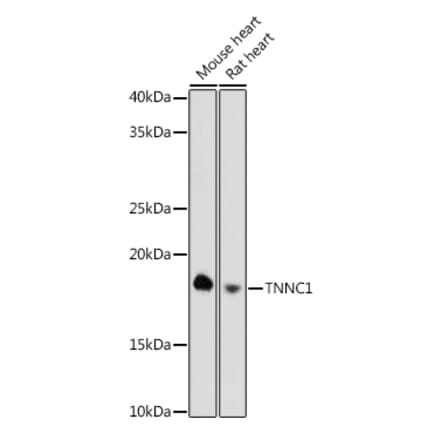 Western Blot - Anti-TNNC1 Antibody [ARC0840] (A307117) - Antibodies.com