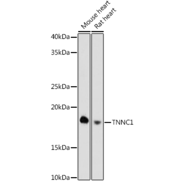 Western Blot - Anti-TNNC1 Antibody [ARC0840] (A307117) - Antibodies.com