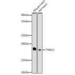 Western Blot - Anti-TNNC1 Antibody [ARC0840] (A307117) - Antibodies.com