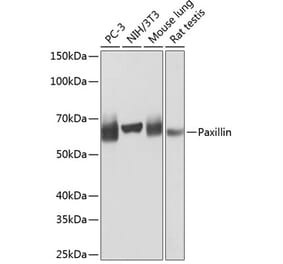 Western Blot - Anti-Paxillin Antibody [ARC0368] (A307119) - Antibodies.com