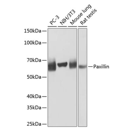 Western Blot - Anti-Paxillin Antibody [ARC0368] (A307119) - Antibodies.com