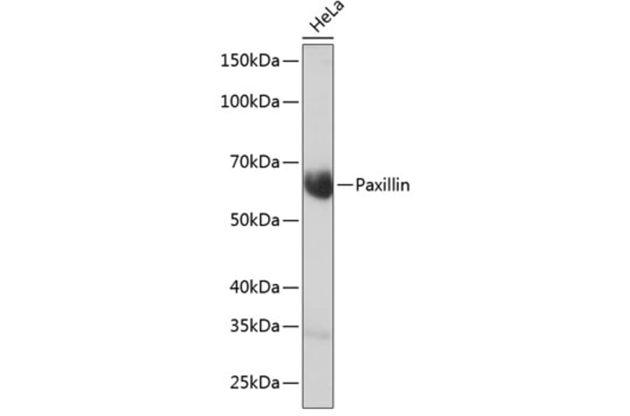 Western Blot - Anti-Paxillin Antibody [ARC0368] (A307119) - Antibodies.com