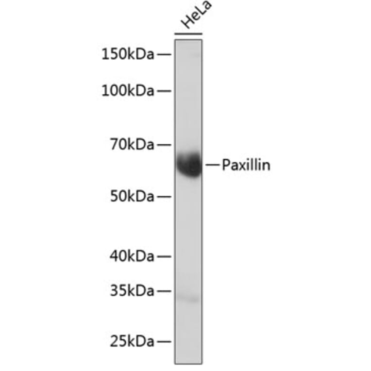 Western Blot - Anti-Paxillin Antibody [ARC0368] (A307119) - Antibodies.com