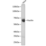Western Blot - Anti-Paxillin Antibody [ARC0368] (A307119) - Antibodies.com