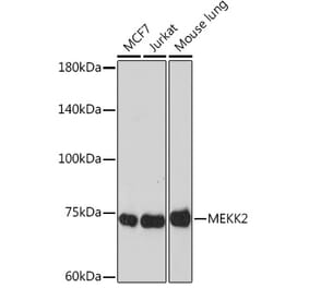 Western Blot - Anti-MEKK2 Antibody [ARC2291] (A307120) - Antibodies.com