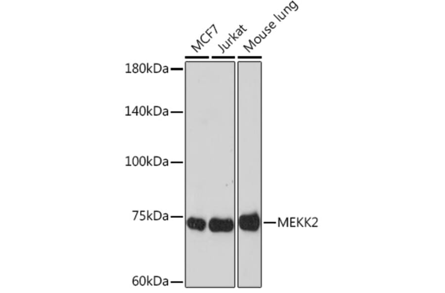 Western Blot - Anti-MEKK2 Antibody [ARC2291] (A307120) - Antibodies.com