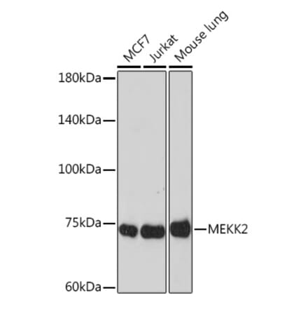 Western Blot - Anti-MEKK2 Antibody [ARC2291] (A307120) - Antibodies.com
