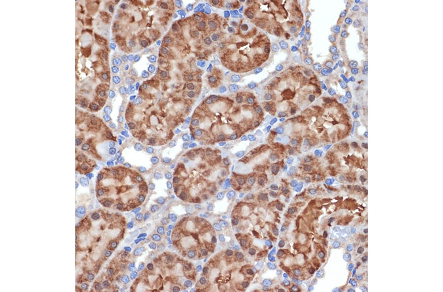 Immunohistochemistry - Anti-MEKK2 Antibody [ARC2291] (A307120) - Antibodies.com