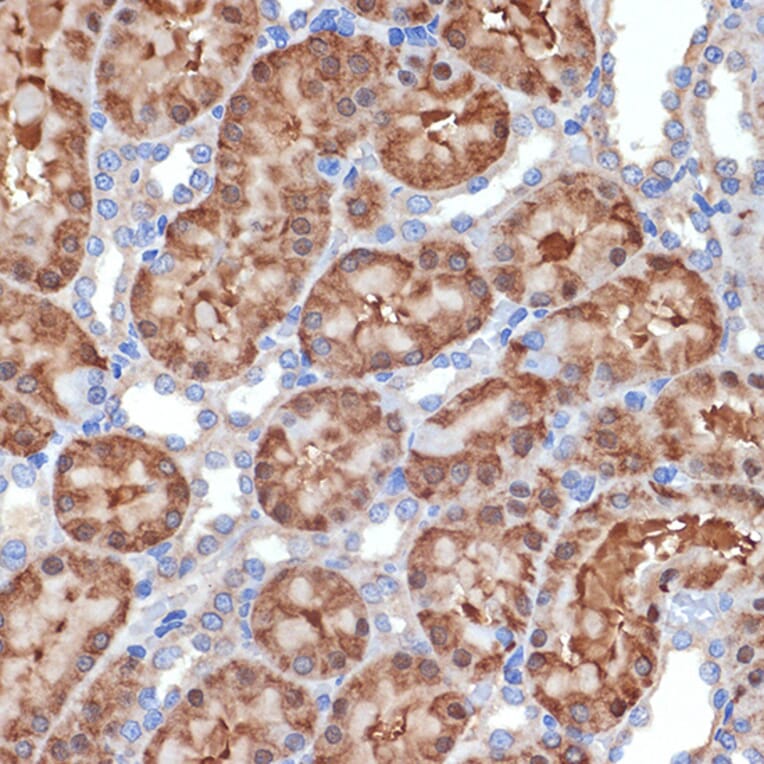 Immunohistochemistry - Anti-MEKK2 Antibody [ARC2291] (A307120) - Antibodies.com