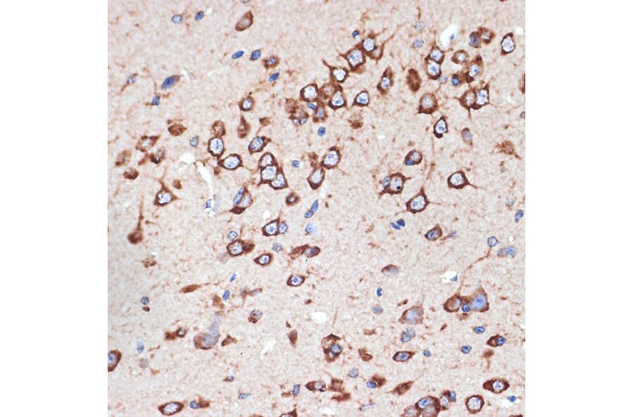Immunohistochemistry - Anti-MEKK2 Antibody [ARC2291] (A307120) - Antibodies.com