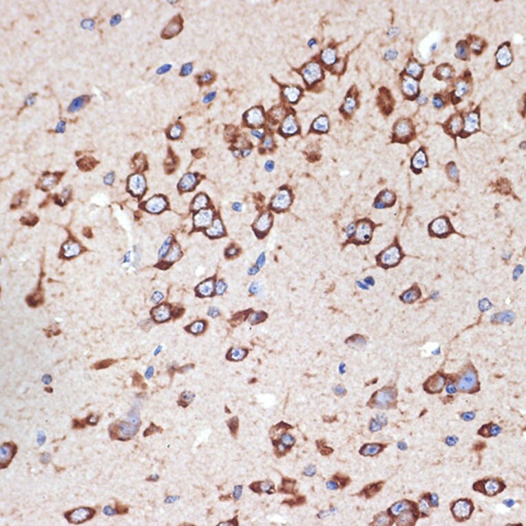 Immunohistochemistry - Anti-MEKK2 Antibody [ARC2291] (A307120) - Antibodies.com