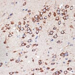 Immunohistochemistry - Anti-MEKK2 Antibody [ARC2291] (A307120) - Antibodies.com