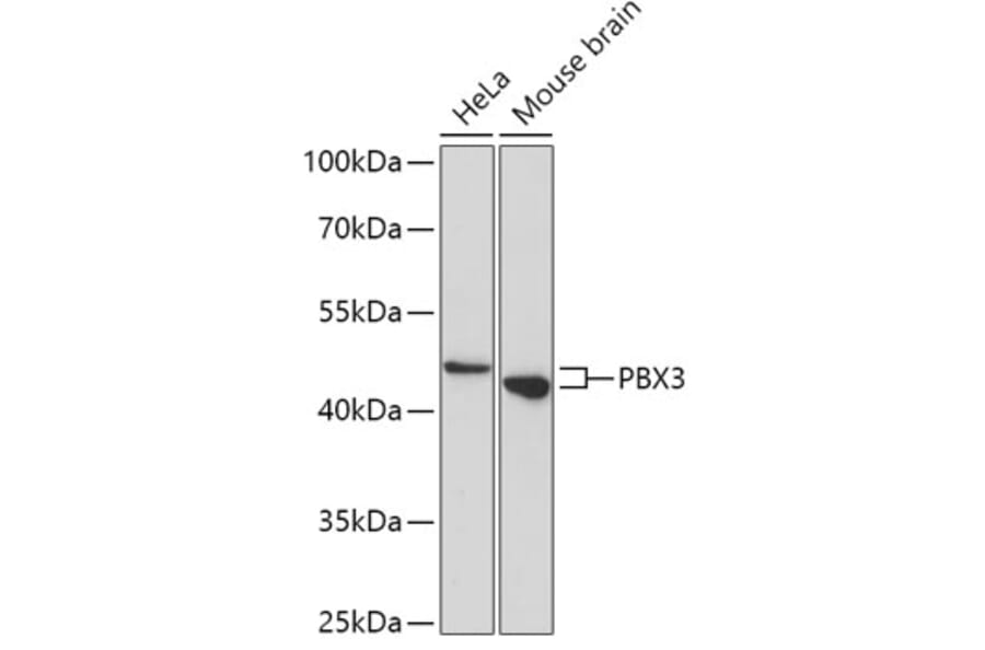 Western Blot - Anti-Pbx3 Antibody (A307121) - Antibodies.com