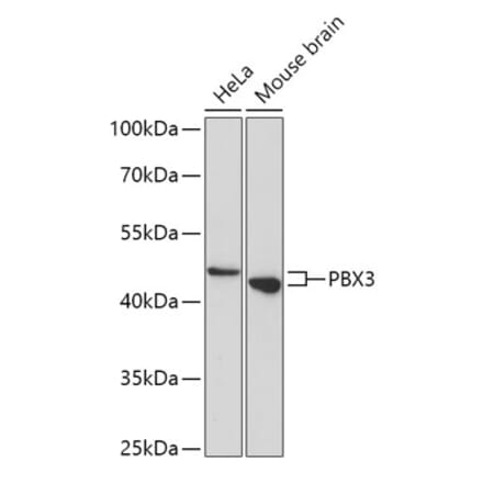 Western Blot - Anti-Pbx3 Antibody (A307121) - Antibodies.com