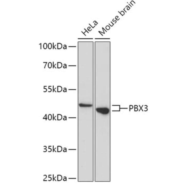 Western Blot - Anti-Pbx3 Antibody (A307121) - Antibodies.com