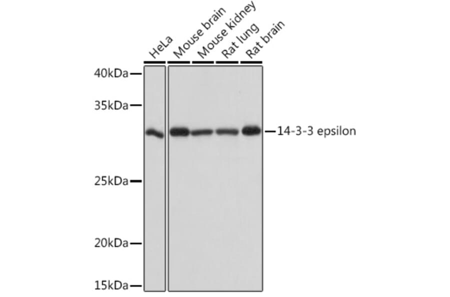 Western Blot - Anti-YWHAE Antibody [ARC1222] (A307122) - Antibodies.com