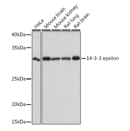 Western Blot - Anti-YWHAE Antibody [ARC1222] (A307122) - Antibodies.com