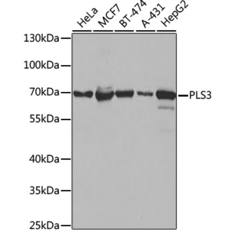 Western Blot - Anti-T Plastin / PLS3 Antibody (A307123) - Antibodies.com