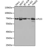 Western Blot - Anti-T Plastin / PLS3 Antibody (A307123) - Antibodies.com