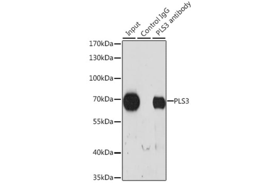 Western Blot - Anti-T Plastin / PLS3 Antibody (A307123) - Antibodies.com
