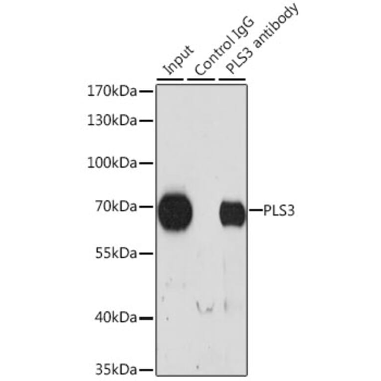 Western Blot - Anti-T Plastin / PLS3 Antibody (A307123) - Antibodies.com