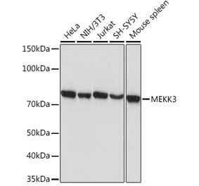 Western Blot - Anti-MEKK3 Antibody [ARC2074] (A307125) - Antibodies.com