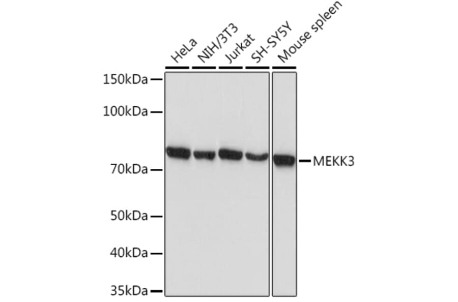 Western Blot - Anti-MEKK3 Antibody [ARC2074] (A307125) - Antibodies.com