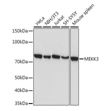 Western Blot - Anti-MEKK3 Antibody [ARC2074] (A307125) - Antibodies.com