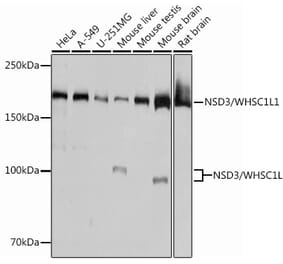Western Blot - Anti-NSD3 Antibody [ARC0707] (A307126) - Antibodies.com