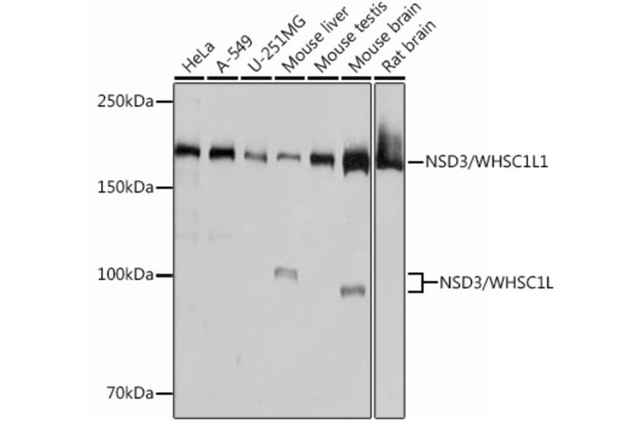 Western Blot - Anti-NSD3 Antibody [ARC0707] (A307126) - Antibodies.com