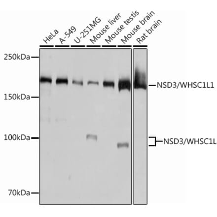 Western Blot - Anti-NSD3 Antibody [ARC0707] (A307126) - Antibodies.com