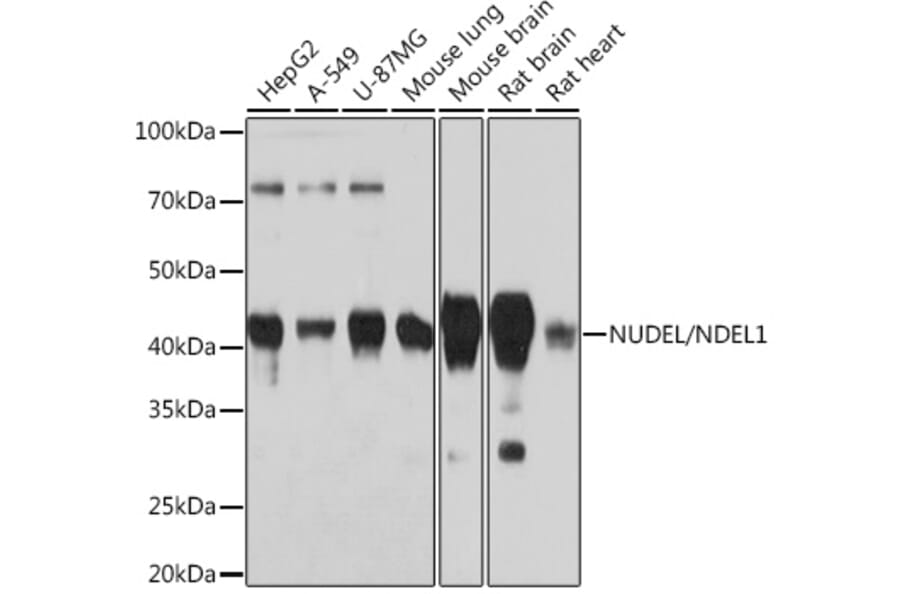 Western Blot - Anti-NDEL1 Antibody [ARC0835] (A307127) - Antibodies.com