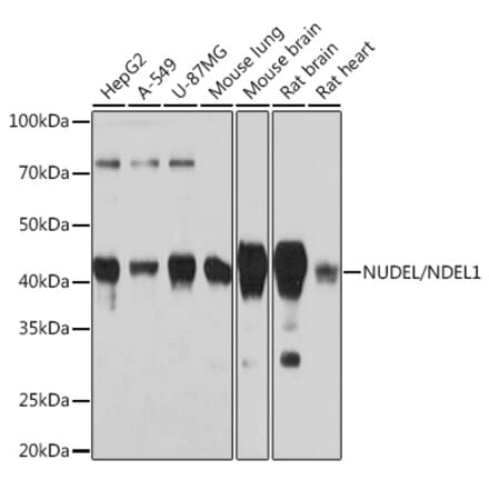 Western Blot - Anti-NDEL1 Antibody [ARC0835] (A307127) - Antibodies.com