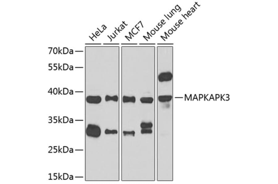 Western Blot - Anti-MK-3 Antibody (A307128) - Antibodies.com