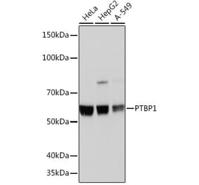 Western Blot - Anti-PTBP1 Antibody [ARC0783] (A307129) - Antibodies.com