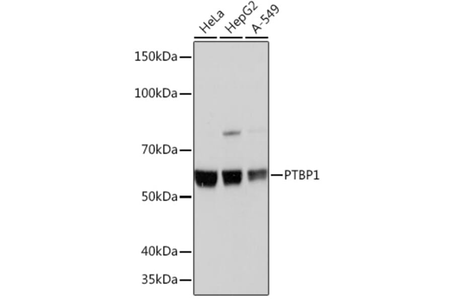 Western Blot - Anti-PTBP1 Antibody [ARC0783] (A307129) - Antibodies.com