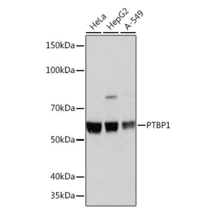 Western Blot - Anti-PTBP1 Antibody [ARC0783] (A307129) - Antibodies.com