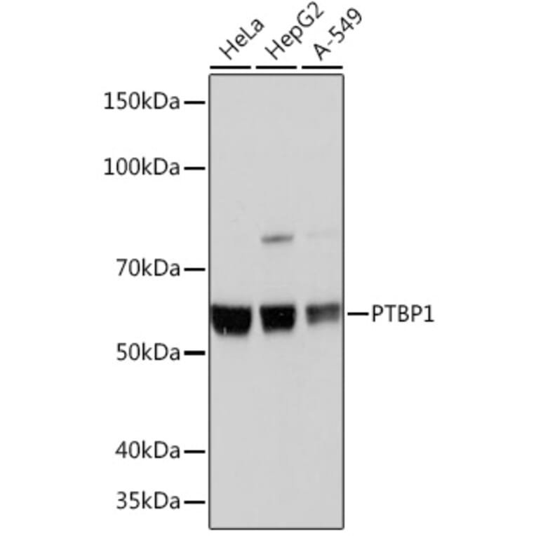 Western Blot - Anti-PTBP1 Antibody [ARC0783] (A307129) - Antibodies.com