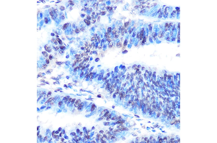 Immunohistochemistry - Anti-PTBP1 Antibody [ARC0783] (A307129) - Antibodies.com