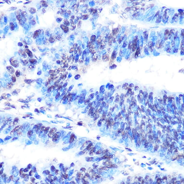 Immunohistochemistry - Anti-PTBP1 Antibody [ARC0783] (A307129) - Antibodies.com
