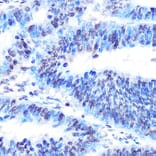 Immunohistochemistry - Anti-PTBP1 Antibody [ARC0783] (A307129) - Antibodies.com