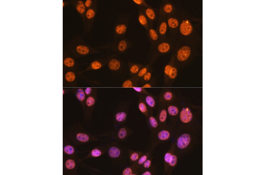 Immunofluorescence - Anti-PTBP1 Antibody [ARC0783] (A307129) - Antibodies.com