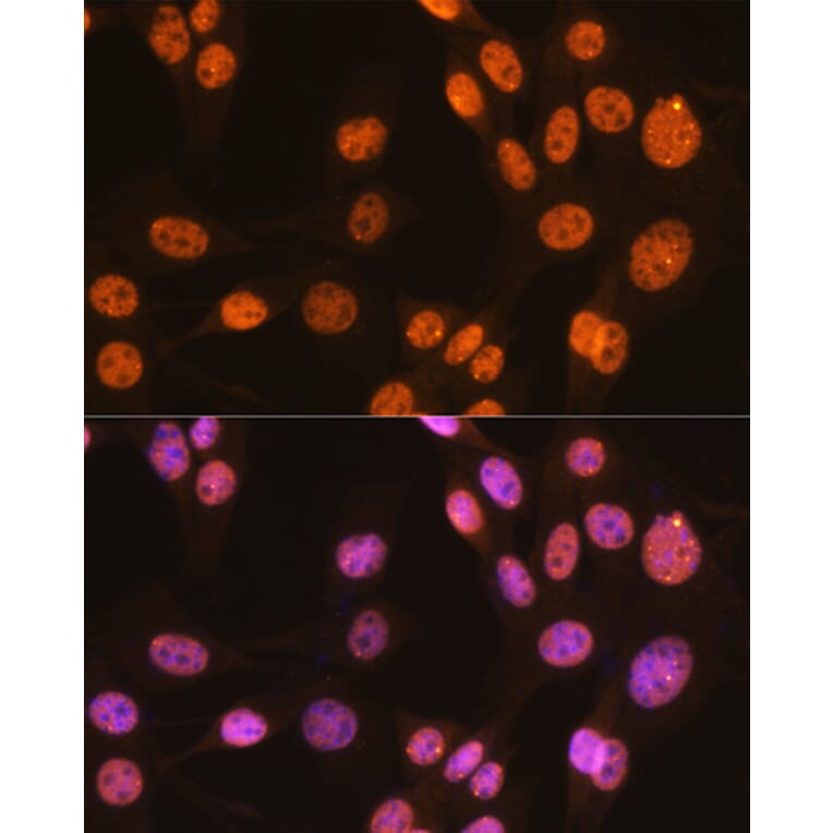 Immunofluorescence - Anti-PTBP1 Antibody [ARC0783] (A307129) - Antibodies.com