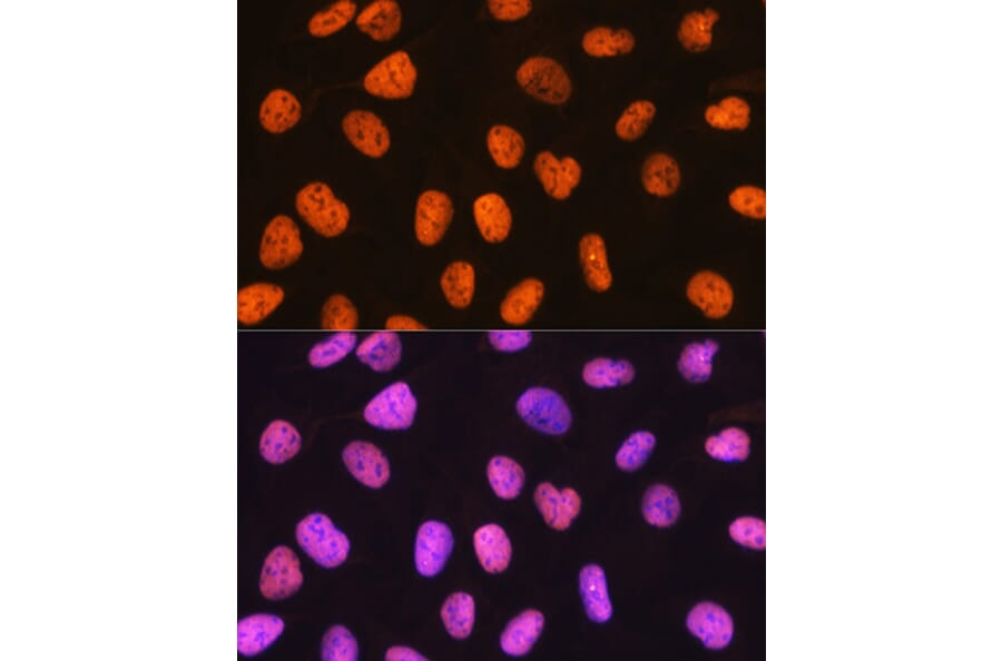 Immunofluorescence - Anti-PTBP1 Antibody [ARC0783] (A307129) - Antibodies.com