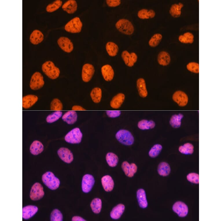 Immunofluorescence - Anti-PTBP1 Antibody [ARC0783] (A307129) - Antibodies.com