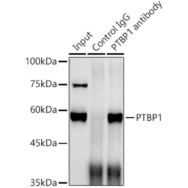 Western Blot - Anti-PTBP1 Antibody [ARC0783] (A307129) - Antibodies.com